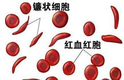 人體香蕉视频APP色版廠家介紹檢測微量元素的儀器 人體香蕉视频APP色版廠家介紹檢測微量元素的儀器
