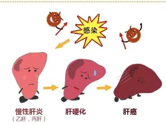 大香蕉啪啪网廠家提醒肝髒疾病治不好？要了解是否含鐵食物攝入多